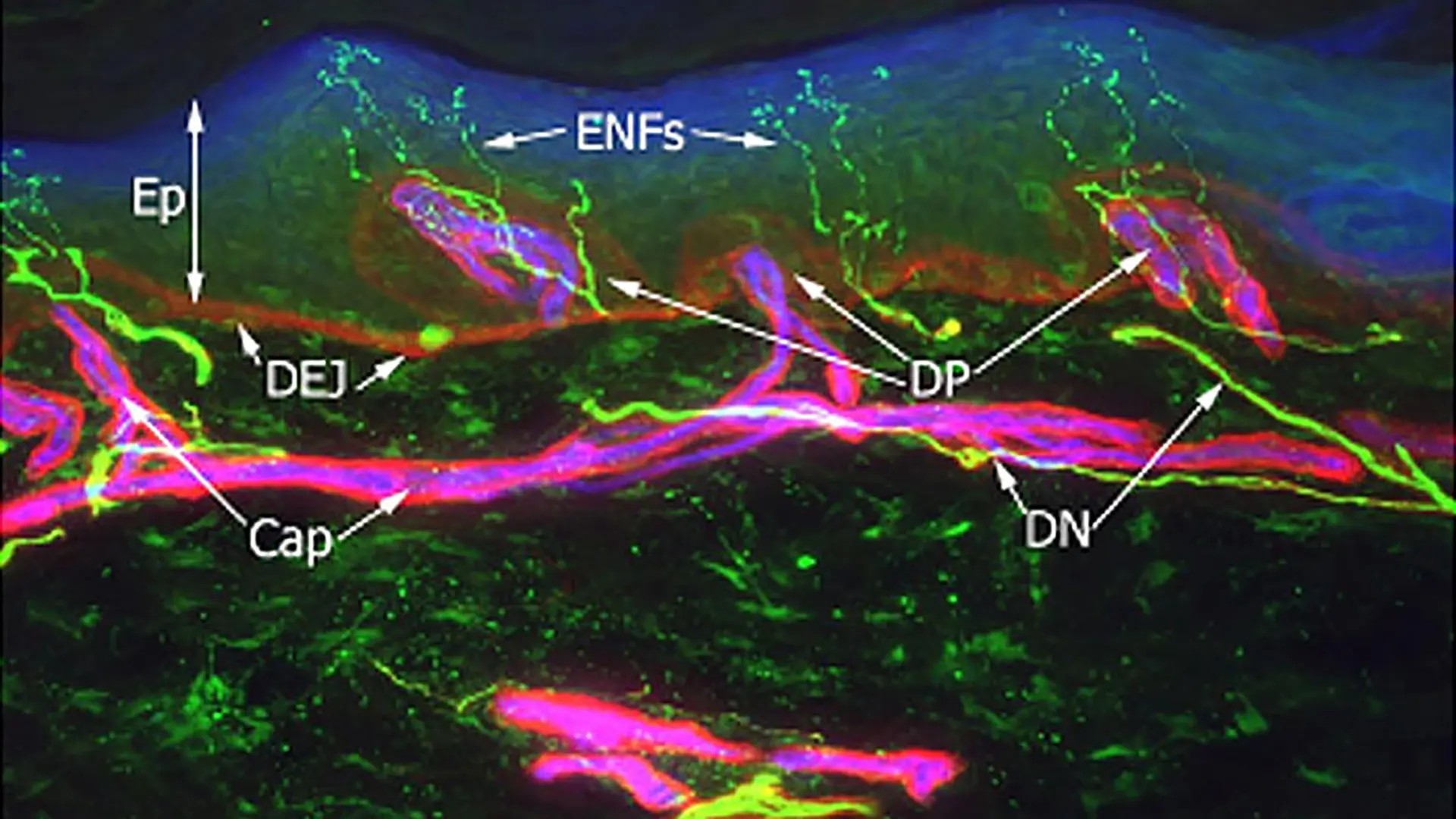 Epidermal nerve fibres